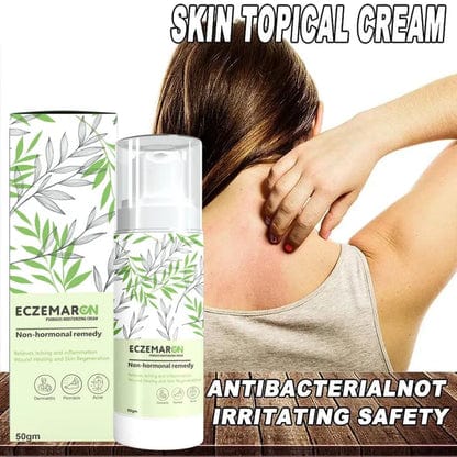 MS Ecze+ Anti Fungal Spray - Doctor's Recommended 👨🏽⚕️ Buy 1 Get 1 Free