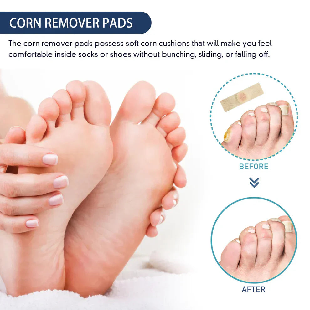 HappyHeel™ Corn Protection Pads (Pack of 24) | BUY 1 GET 1 FREE 🔥