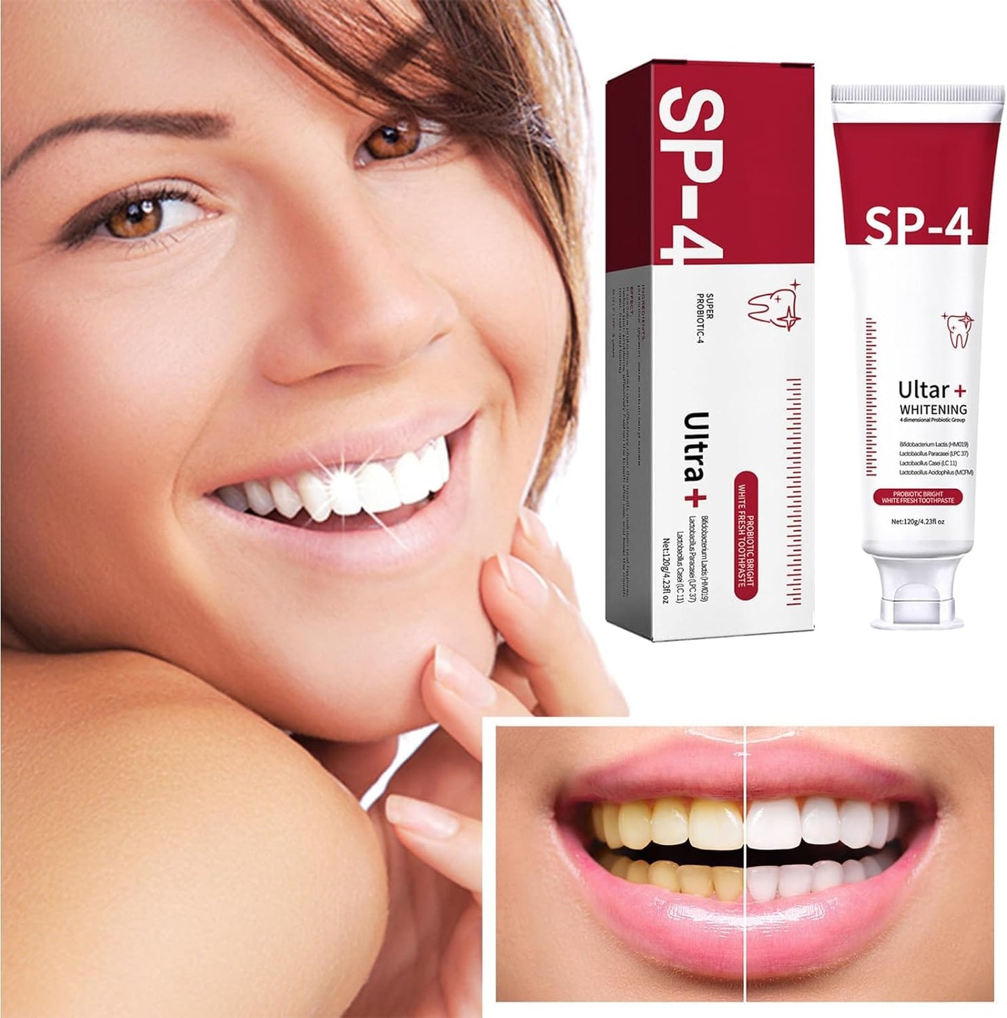 Smilexo™ SP-4 Probiotic Toothpaste (Pack of 2)