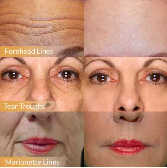 POLYPEPTIDE FIRMING FULL FACE CREAM-CHANGE FOR BEAUTIFUL SKIN WITHIN 2 WEEKS (BUY 1 GET 1 FREE)