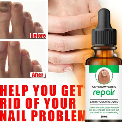 Nail Repair Serum (Buy 1 Get 1 Free)