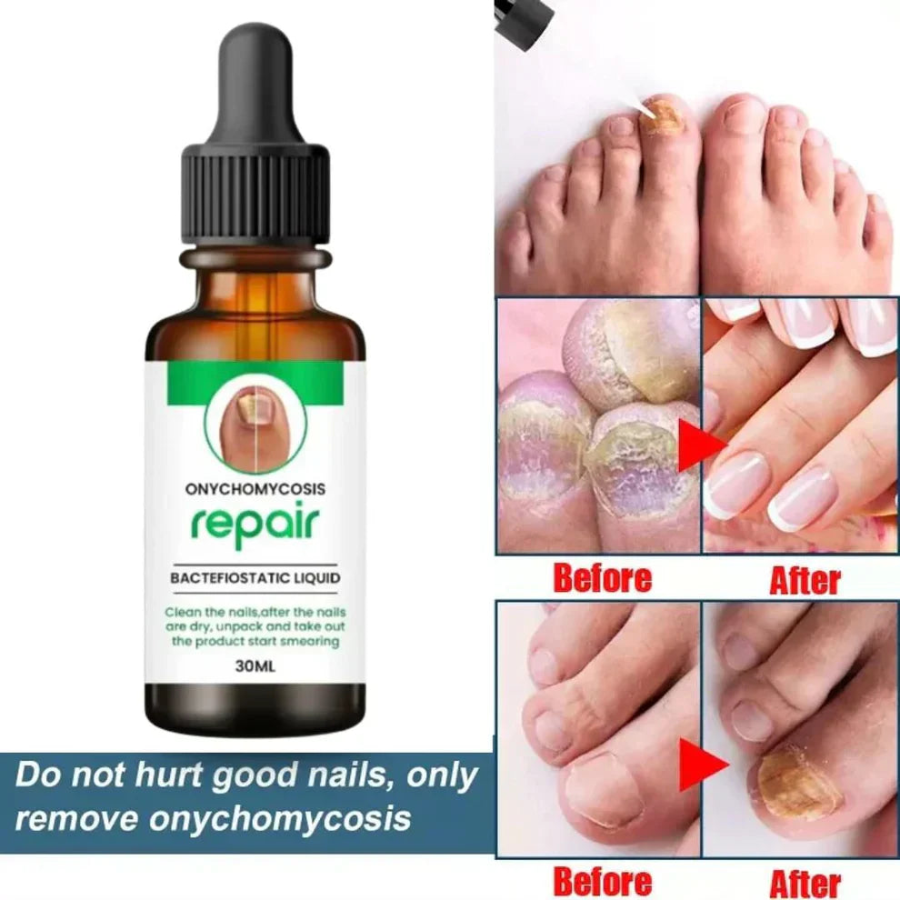 Nail Repair Serum (Buy 1 Get 1 Free)