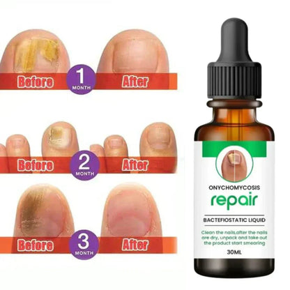 Nail Repair Serum (Buy 1 Get 1 Free)