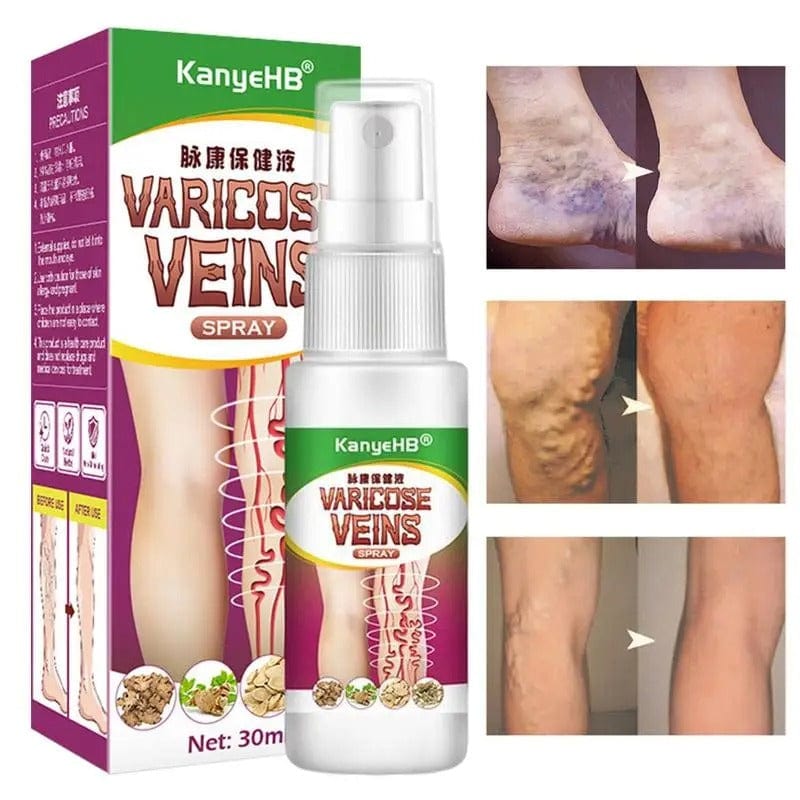 MS Herbal Varicose Vein Spray -  Vein Care Solution! 👨🏻‍⚕️ 💚 Buy 1 Get 1 Free 🔥